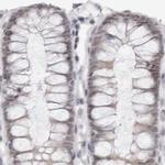 PNPO Antibody in Immunohistochemistry (IHC)