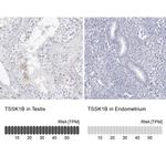 TSSK1 Antibody in Immunohistochemistry (IHC)