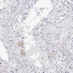 TSSK1 Antibody in Immunohistochemistry (IHC)