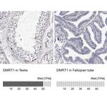 DMRT1 Antibody in Immunohistochemistry (IHC)