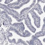 DMRT1 Antibody in Immunohistochemistry (IHC)