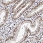 NUP153 Antibody in Immunohistochemistry (IHC)