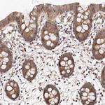 PANK4 Antibody in Immunohistochemistry (IHC)