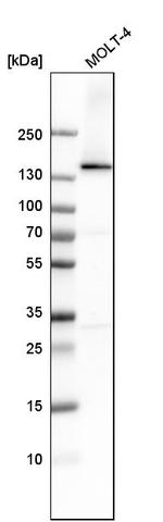 DHX9 Antibody in Western Blot (WB)