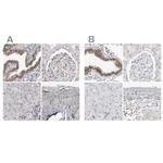 WRAP53 Antibody in Immunohistochemistry (IHC)