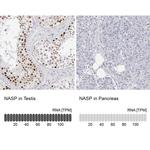 NASP Antibody in Immunohistochemistry (IHC)