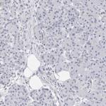 NASP Antibody in Immunohistochemistry (IHC)