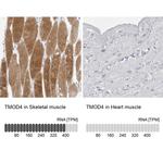 TMOD4 Antibody in Immunohistochemistry (IHC)