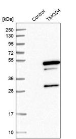 TMOD4 Antibody in Western Blot (WB)