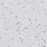 DDX54 Antibody in Immunohistochemistry (IHC)