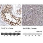 RALGPS2 Antibody in Immunohistochemistry (IHC)