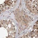 CEP350 Antibody in Immunohistochemistry (IHC)