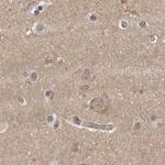 CEP350 Antibody in Immunohistochemistry (IHC)