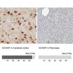 C1orf96 Antibody in Immunohistochemistry (IHC)