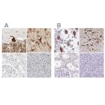 C1orf96 Antibody in Immunohistochemistry (IHC)