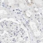 C1orf96 Antibody in Immunohistochemistry (IHC)