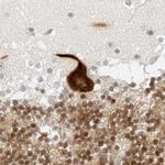 C1orf96 Antibody in Immunohistochemistry (IHC)