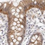 Annexin A9 Antibody in Immunohistochemistry (IHC)