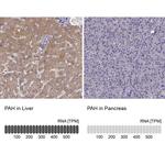 PAH Antibody in Immunohistochemistry (IHC)