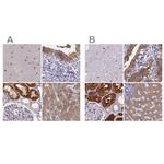 PAH Antibody in Immunohistochemistry (IHC)