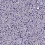 PAH Antibody in Immunohistochemistry (IHC)