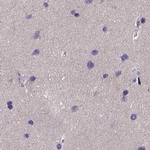 PAH Antibody in Immunohistochemistry (IHC)