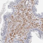 LMOD1 Antibody in Immunohistochemistry (IHC)