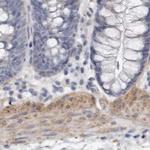 LMOD1 Antibody in Immunohistochemistry (IHC)