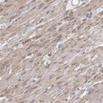 LMOD1 Antibody in Immunohistochemistry (IHC)