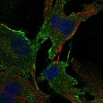 ADAMTS2 Antibody in Immunocytochemistry (ICC/IF)