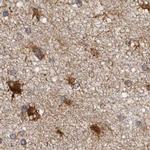 ENAH Antibody in Immunohistochemistry (IHC)