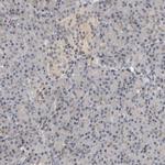 HENMT1 Antibody in Immunohistochemistry (IHC)