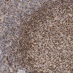 HENMT1 Antibody in Immunohistochemistry (IHC)