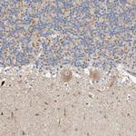 KIF26B Antibody in Immunohistochemistry (IHC)