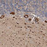 KIF26B Antibody in Immunohistochemistry (IHC)