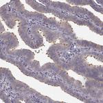 SPAG17 Antibody in Immunohistochemistry (IHC)