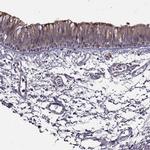 SPAG17 Antibody in Immunohistochemistry (IHC)