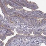 SPAG17 Antibody in Immunohistochemistry (IHC)