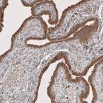 RAB11FIP3 Antibody in Immunohistochemistry (IHC)