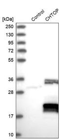 C1orf77 Antibody in Western Blot (WB)