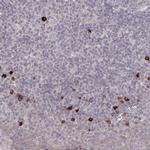 HCAR2 Antibody in Immunohistochemistry (IHC)