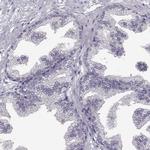 SPAG17 Antibody in Immunohistochemistry (IHC)