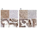 ENAH Antibody in Immunohistochemistry (IHC)