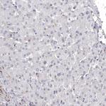 ENAH Antibody in Immunohistochemistry (IHC)