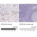 V-ATPase G3 Antibody