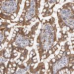 SULT1E1 Antibody in Immunohistochemistry (IHC)