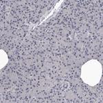 SULT1E1 Antibody in Immunohistochemistry (IHC)