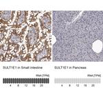 SULT1E1 Antibody