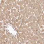 PPP1R3B Antibody in Immunohistochemistry (IHC)