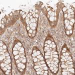 PPP1R3B Antibody in Immunohistochemistry (IHC)